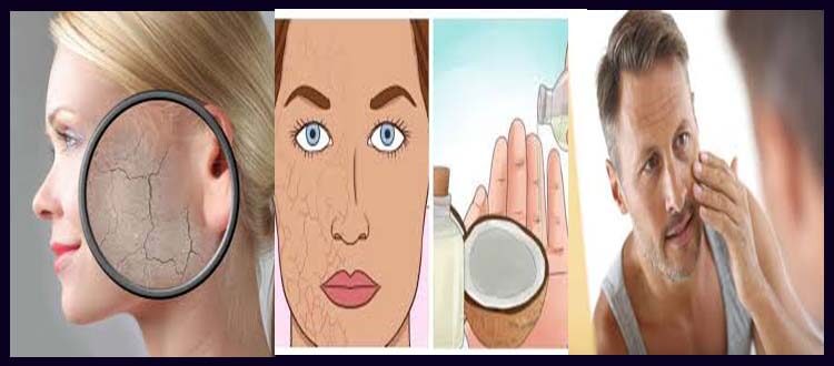 what causes dry skin
