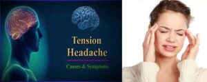 How to treat a tension headache